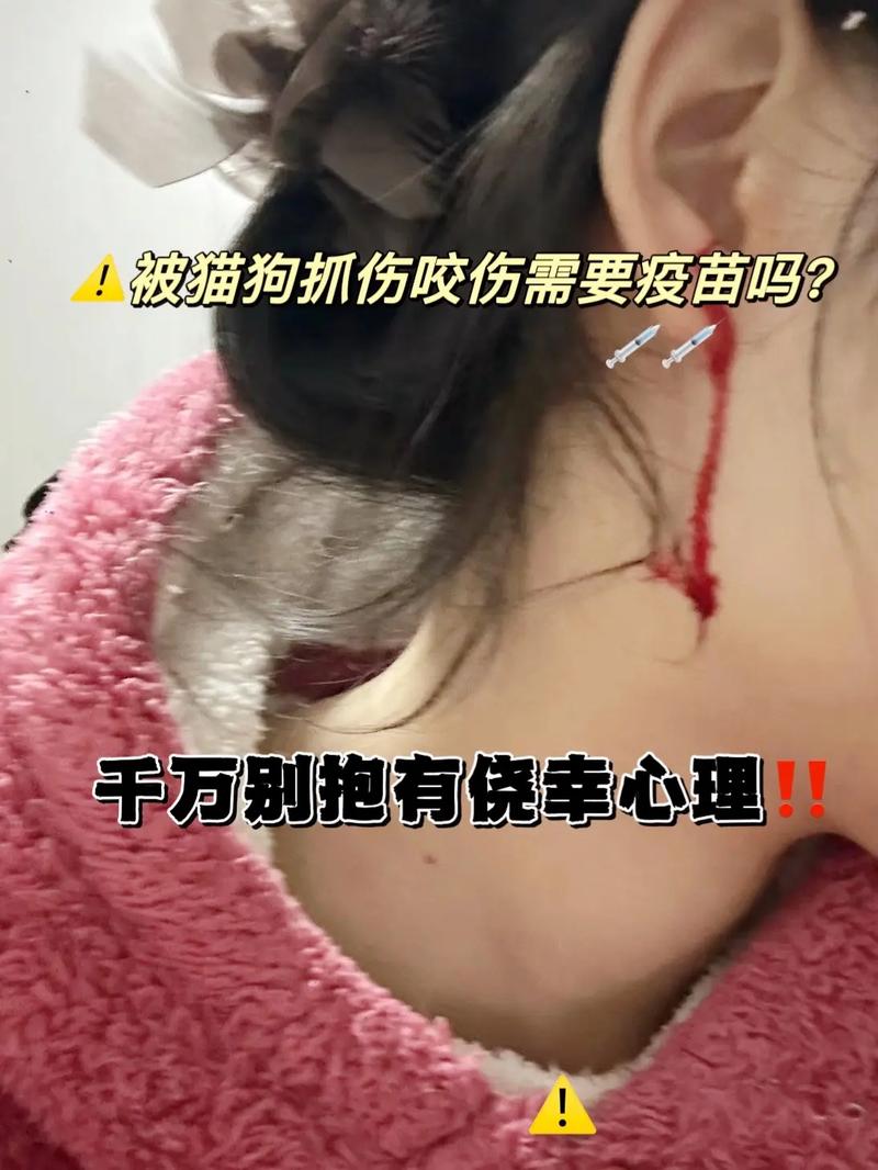 被宠物猫咬伤腿溃烂